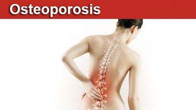 El ozono una importante terapia para combatir  la osteoporosis